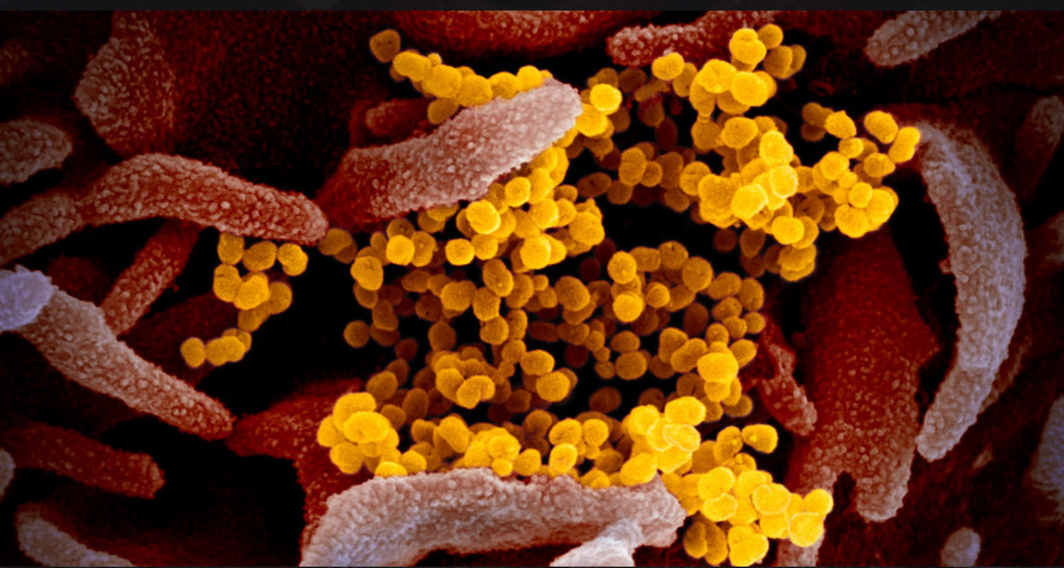 Novel Coronavirus SARS-CoV-2
